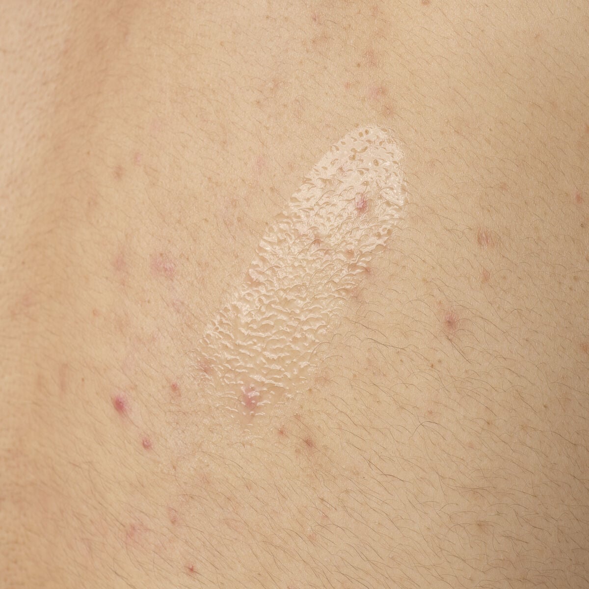 salicylic-acid-0-5-body-serum-j5 ORD-salicylic-acid-05-body-240ml-application.jpg