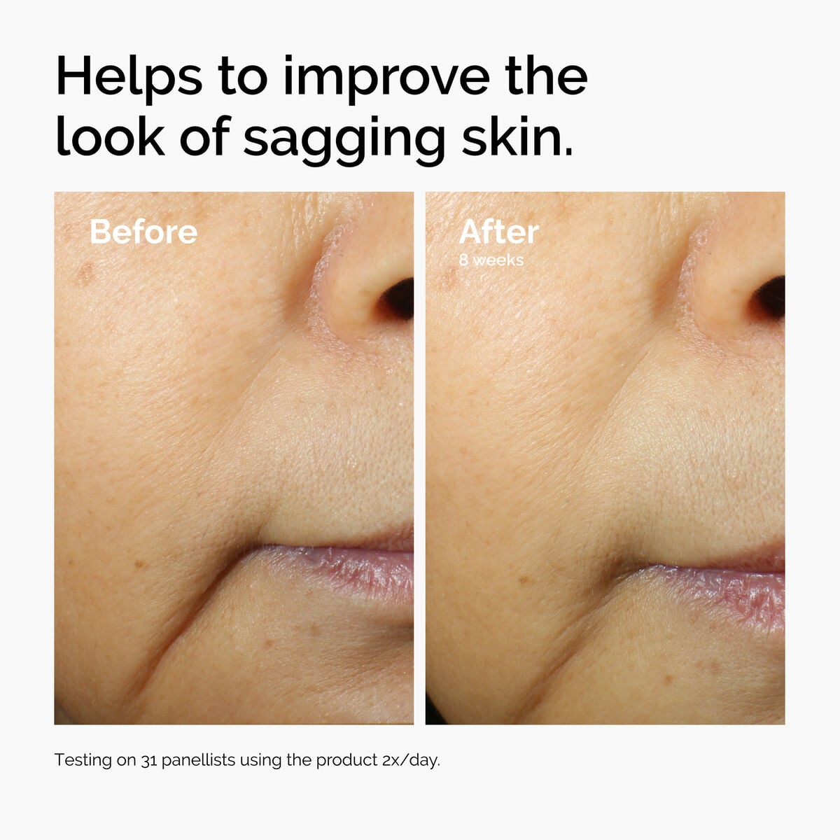caffeine-3-escin-1-face-serum-j3 ord-caffeine-3pct-escin-1pct-face-serum-before-after-sagging.jpg