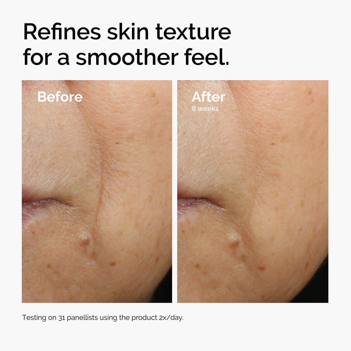 caffeine-3-escin-1-face-serum-j3 ord-caffeine-3pct-escin-1pct-face-serum-before-after-texture.jpg