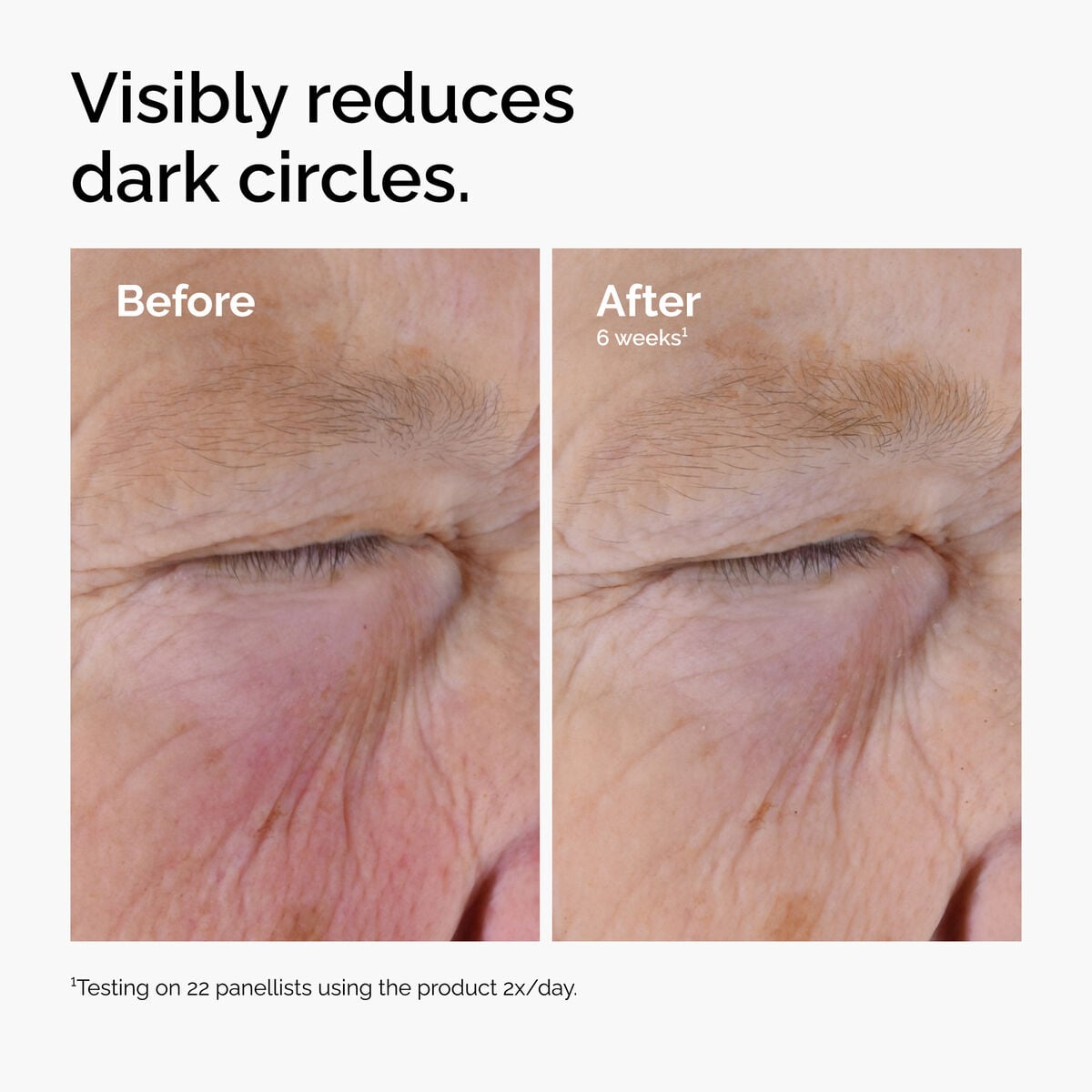 caffeine-solution-5-egcg-eye-serum-w7 ord-caffeine-solution-egcg-dark-circles-before-after.jpg