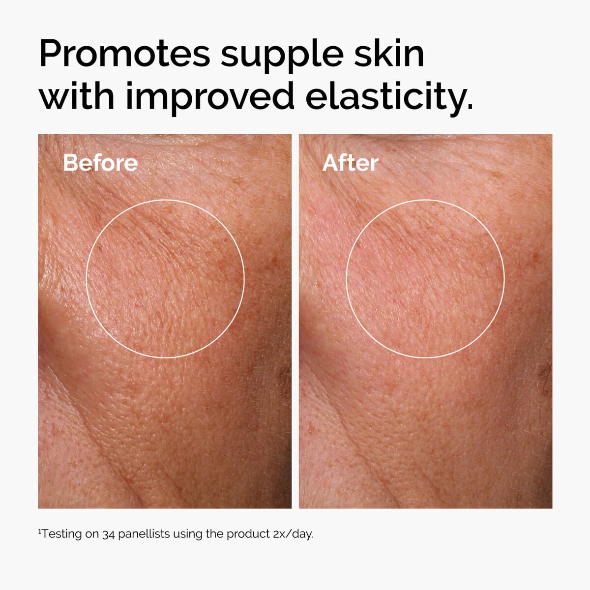 hyaluronic-acid-2-b5-with-ceramides-b5 ord-hyaluronic-acid-2pct-b5-hydrating-serum-before-after-elasticity.jpg