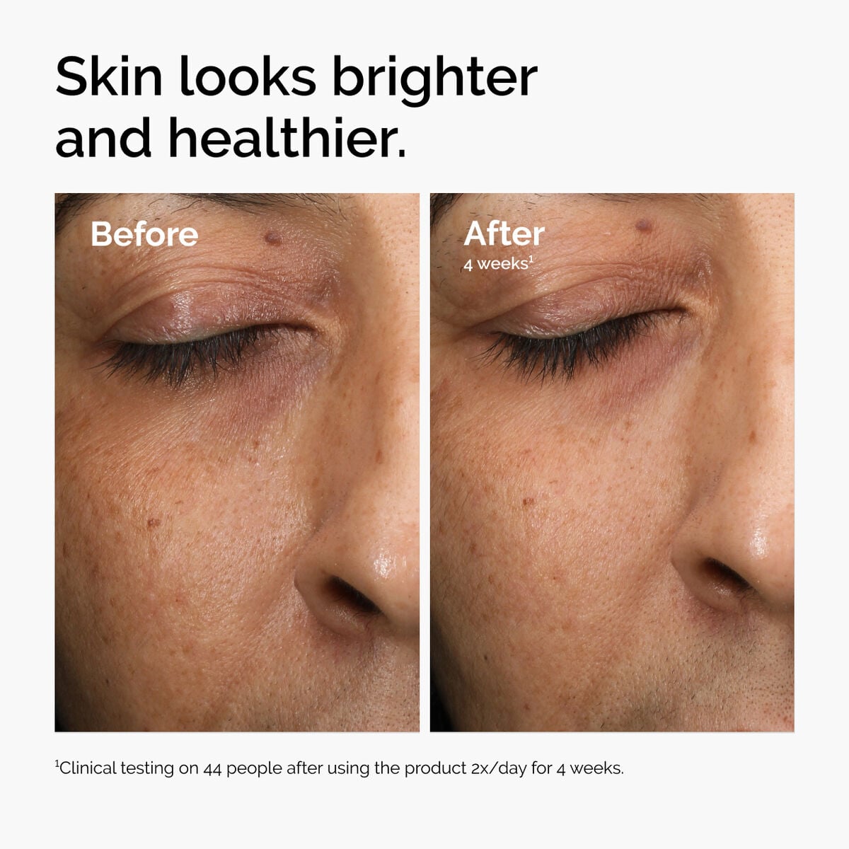 multi-antioxidant-radiance-serum-c8 ord-mars-before-after-healthy.jpg