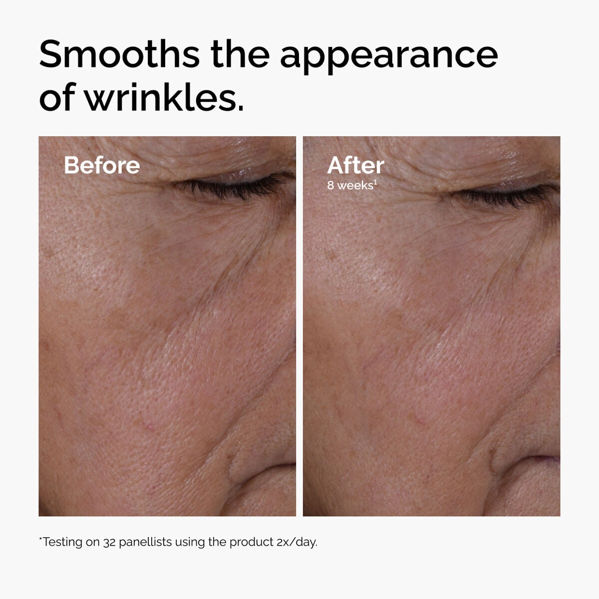 multi-peptide-ha-serum-i3 ord-multi-peptide-ha-serum-wrinkles-before-after.jpg