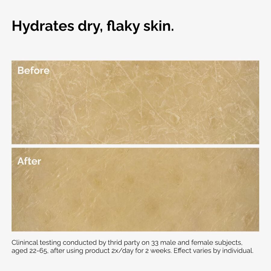 the-body-care-collection-z1 ord-natural-moisturizing-factors-inulin-body-before-after-graphic-02.jpg