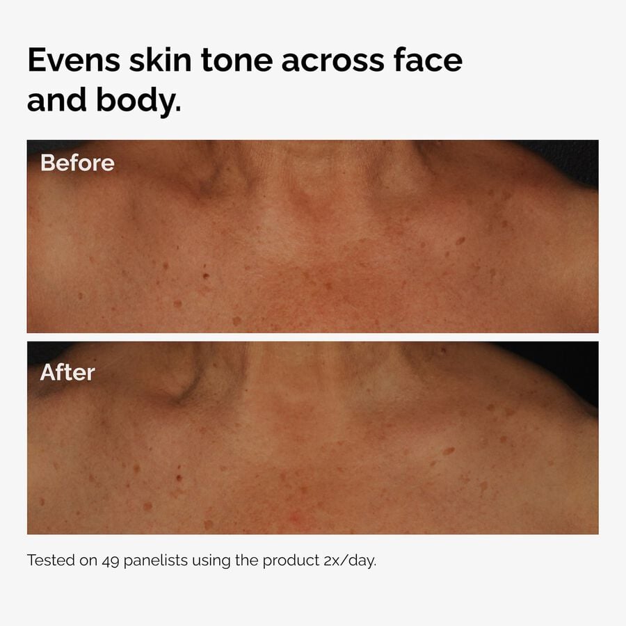 the-body-care-collection-z1 ord-niacinamide-face-body-serum-before-after-even-tone-graphic.jpg