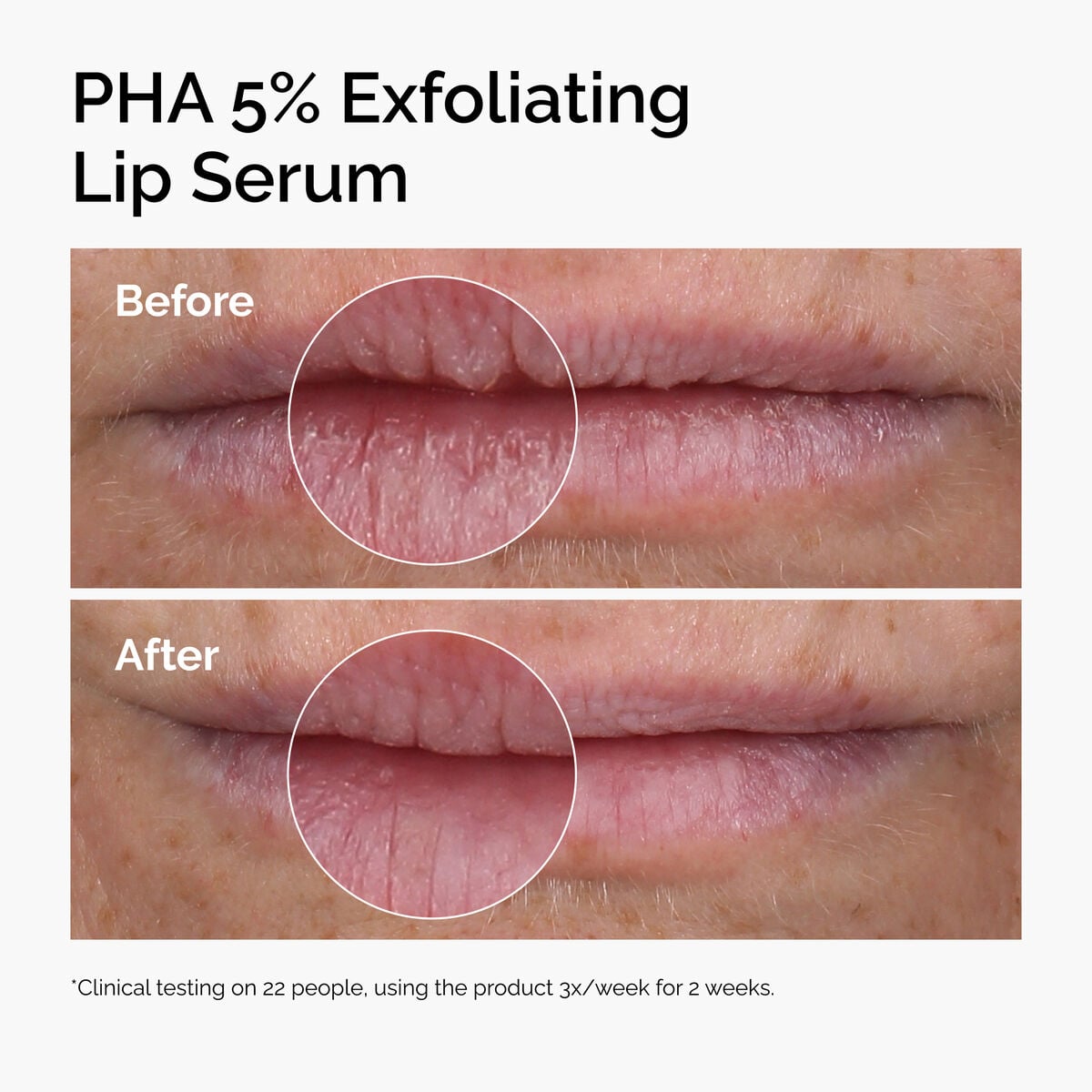 pha-5-exfoliating-lip-serum-s7 ord-pha-5pct-lip-exfoliating-serum-before-after.jpg